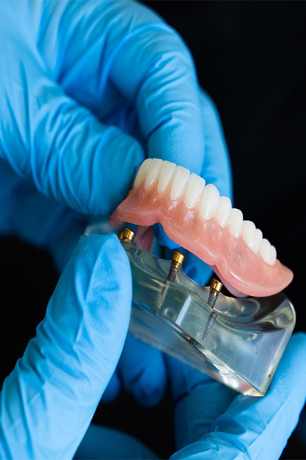 prótesis Clínica Martínez Rioboo en A Coruña