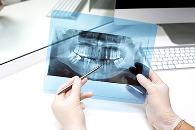 endodoncia clínica dental Martínez Rioboo