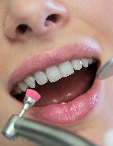 tratamientos periodoncia en A Coruña clínica dental Martínez Rioboo