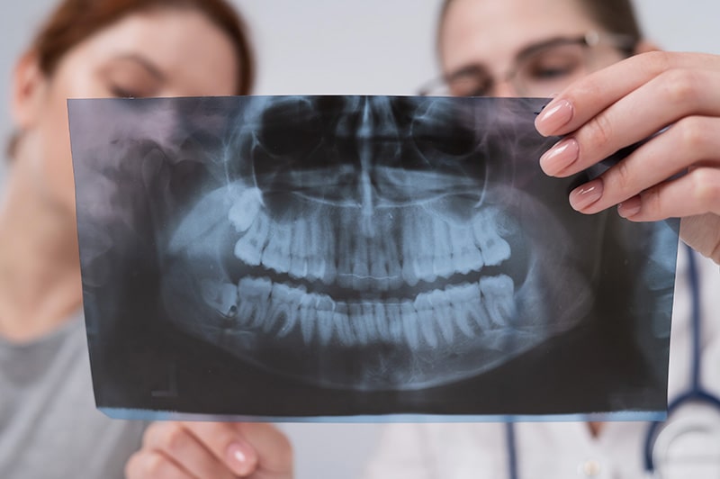 radiografía dental mujeres embarazadas y niños