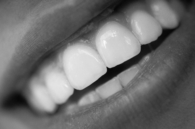 Desventajas implantes de zirconio