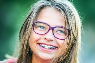 Cuándo es buen momento para colocar una ortodoncia infantil