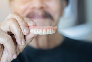 Diferencias entre corona dental, puente y dentadura removible