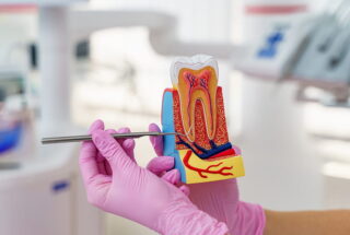 Endodoncia cómo salvar un diente que parece perdido