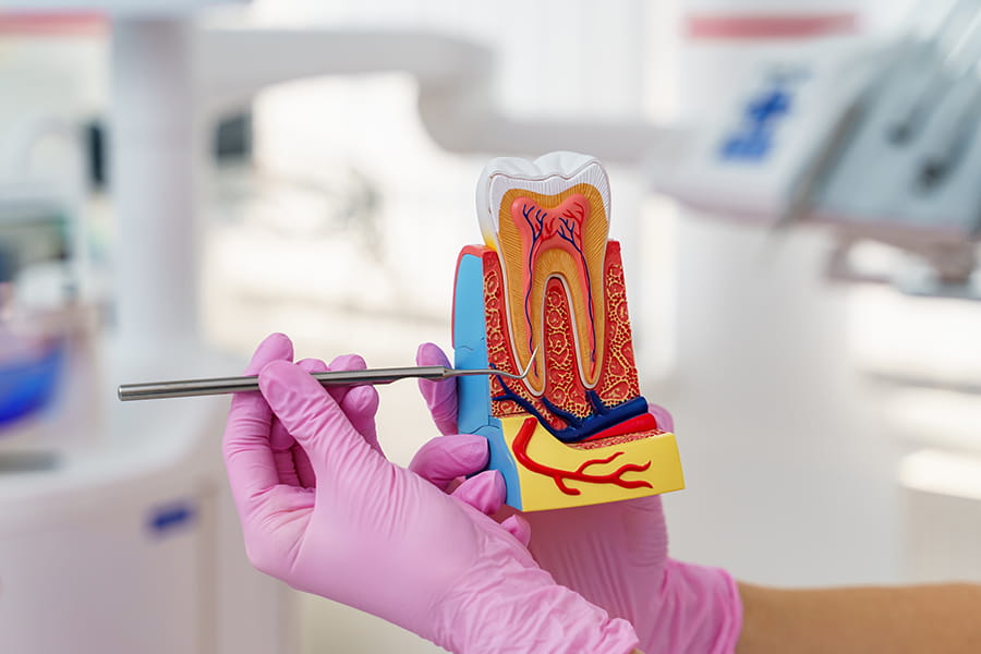 Endodoncia cómo salvar un diente que parece perdido