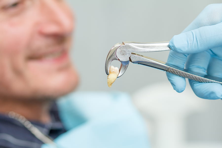 Cuánto tarda en curarse una extracción dental