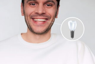 Implantes dentales de circonio o titanio