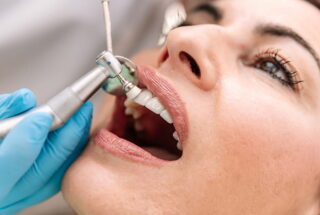 Limpieza dental o curetaje